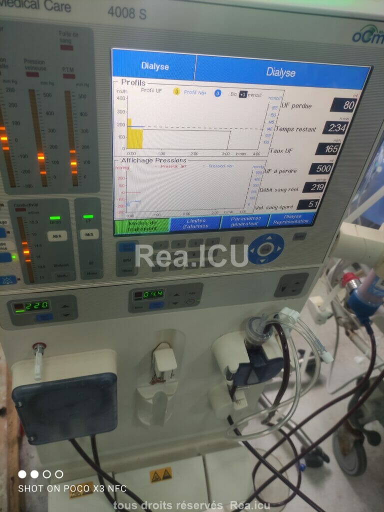 Appareil hemodialyse 4008 S