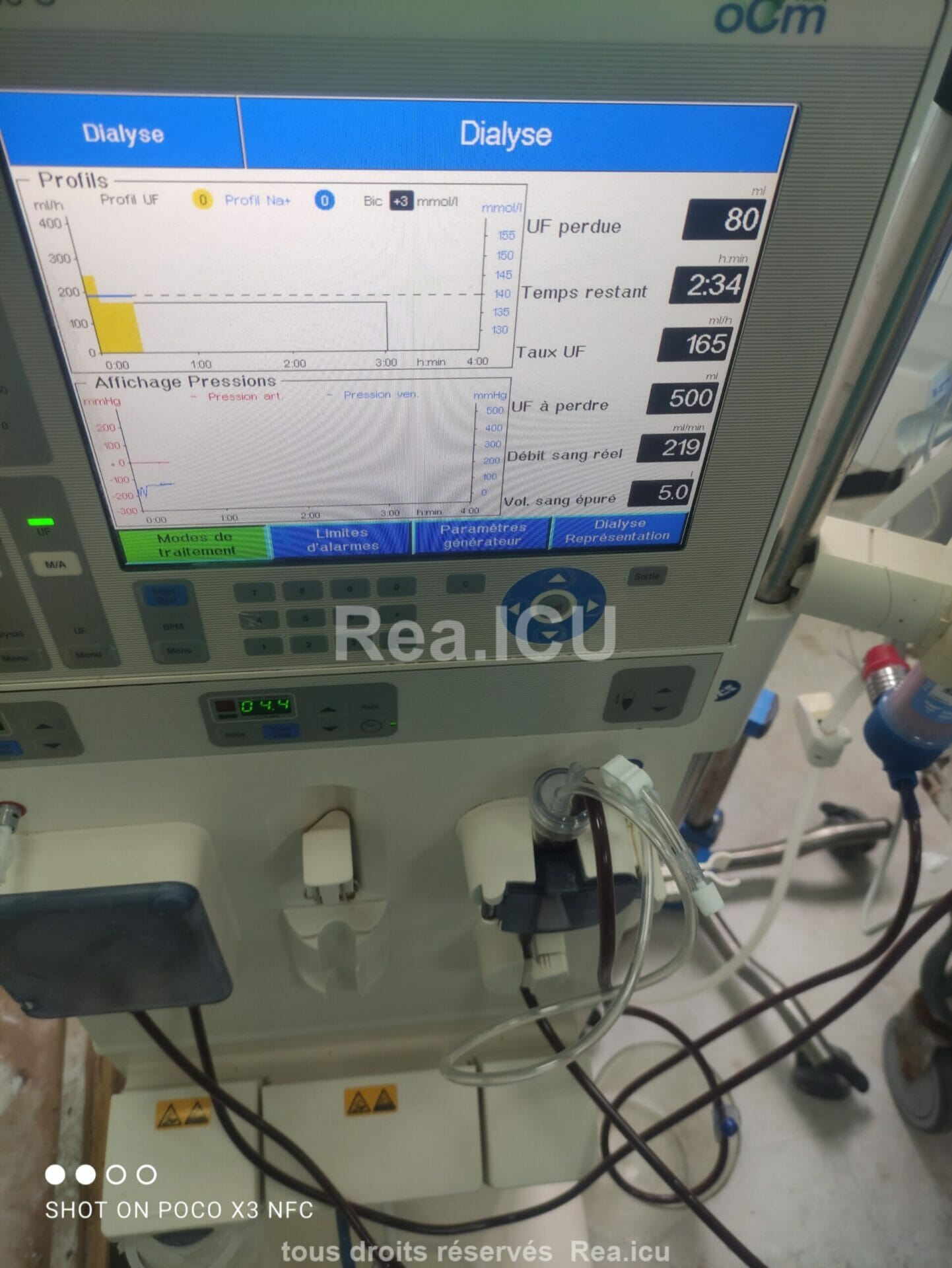 Moniteur hemodialyse 4008 S scaled