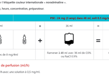 calcule de dose noradrenaline exemple