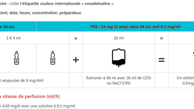 calcule de dose noradrenaline exemple